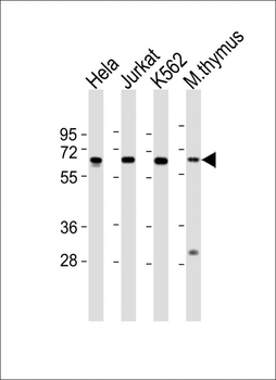 HDAC1 Antibody (C-term)