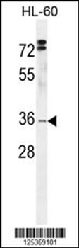 DC12 Antibody (C-term)