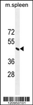 ERCC8 Antibody (Center)