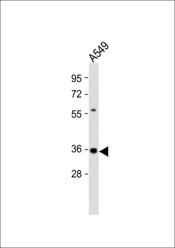 CASP5 Antibody (Center)