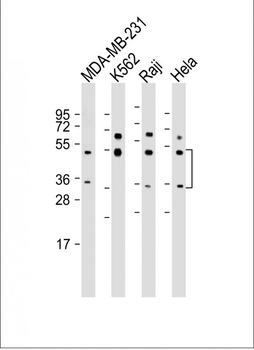 CASP5 Antibody (Center)