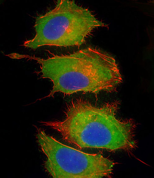 CFH Antibody (Center)