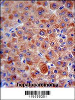 CFH Antibody (Center)