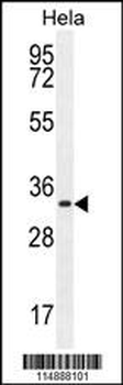 CCNH Antibody (C-term)