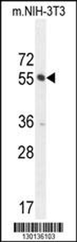 CTDSPL2 Antibody (N-term)