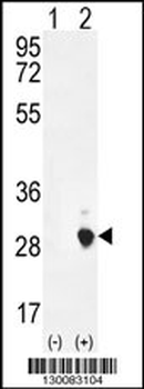 CSH1 Antibody (C-term)