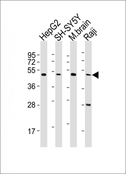 CTBP1 Antibody (C-term)