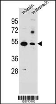 SLC16A11 Antibody (N-term)