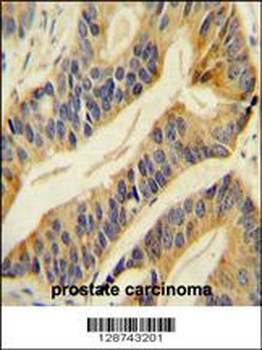 SLC16A11 Antibody (N-term)