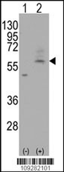 PMAT(Slc29a4) Antibody (C-term)