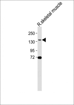 BCORL1 Antibody (N-term)