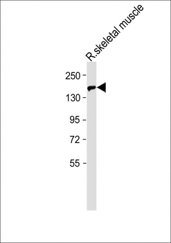 BCORL1 Antibody (N-term)