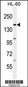 BCORL1 Antibody (N-term)