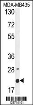 M4A4A Antibody (N-term)