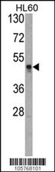 KAT1 (HAT1) Antibody (N-term)