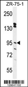ERMP1 Antibody (C-term)