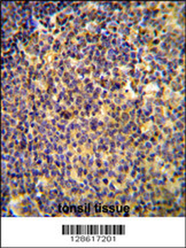 ANR44 Antibody (Center)