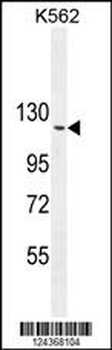 ARHGAP17 Antibody (N-term)