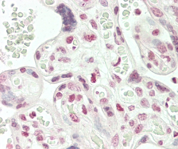 ARHGAP17 Antibody (N-term)
