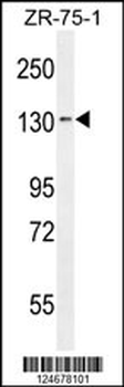 TLL1 Antibody (C-term)