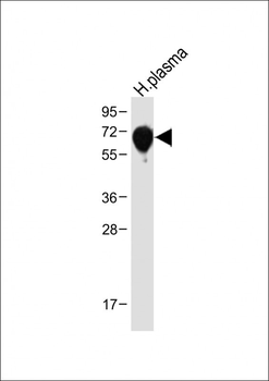 SERPINA6 Antibody (Center)