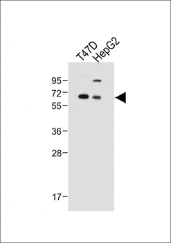 SERPINA6 Antibody (Center)