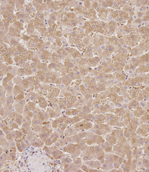 SERPINA6 Antibody (Center)