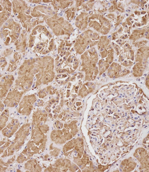 SERPINA6 Antibody (Center)