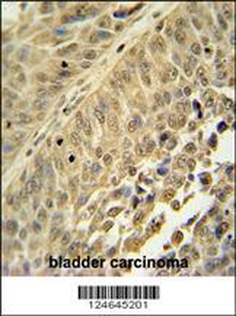 HNRNPC Antibody (C-term)
