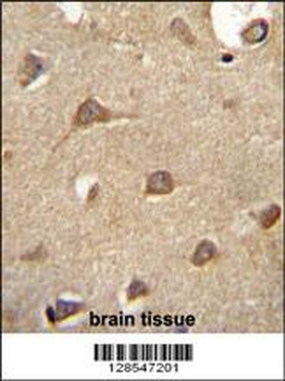 ENTPD3 Antibody (C-term)