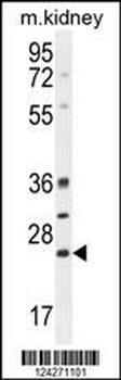 BCL10 Antibody (N-term)