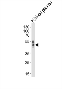 PON1 Antibody (Center)