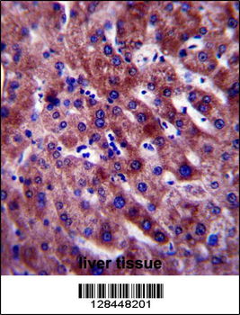 PON1 Antibody (Center)