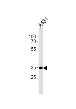 CB2 Antibody (C-term)