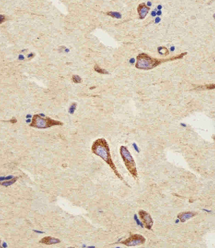 CB2 Antibody (C-term)