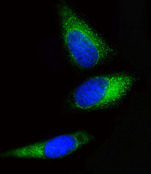 BCKDHB Antibody (N-term)