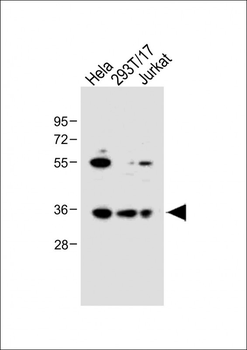 BCKDHB Antibody (N-term)