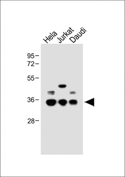BCKDHB Antibody (N-term)