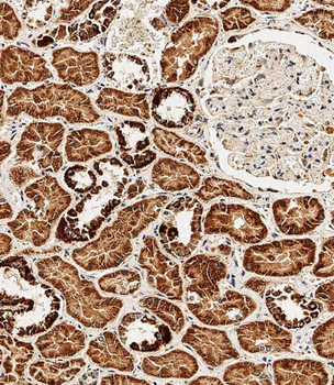 BCKDHB Antibody (N-term)