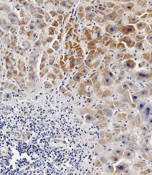 BCKDHB Antibody (N-term)