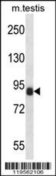 CCNT1 Antibody (Center)