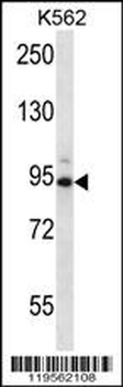 CCNT1 Antibody (Center)