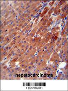 CES2 Antibody (Center)
