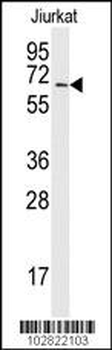 SAE2 (UBA2) Antibody (C-term E616)