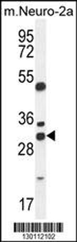 ARV1 Antibody (N-term)