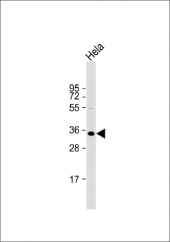 ARV1 Antibody (N-term)
