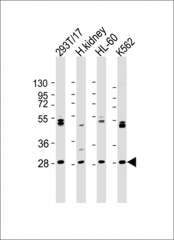 ARV1 Antibody (N-term)