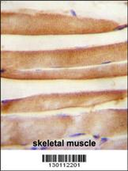 ARV1 Antibody (N-term)