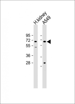 HHLA2 Antibody (N-term)
