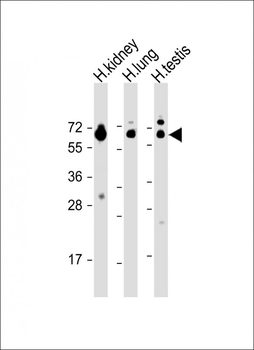 HHLA2 Antibody (N-term)
